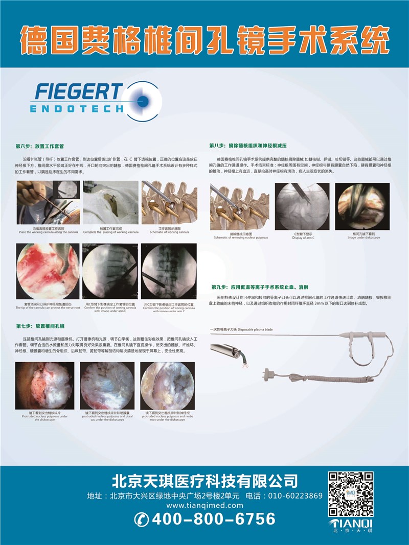 德国费格椎间孔镜手术系统